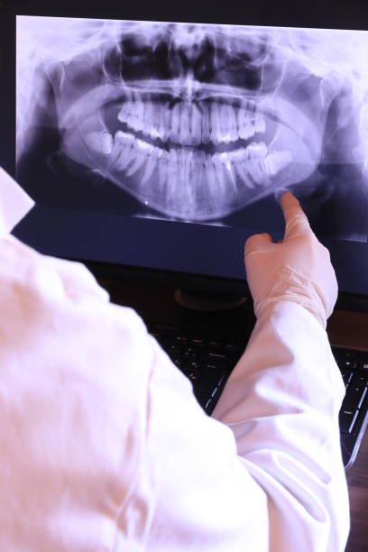 Best Emergency Tooth Extraction in Chepachet, RI