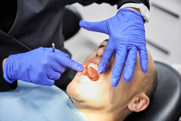 Best Emergency Gum Treatment in Chepachet, RI