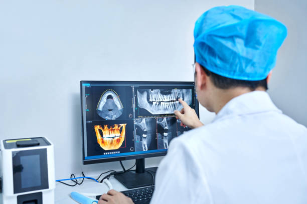 Best Emergency Root Canal Treatment in Chepachet, RI